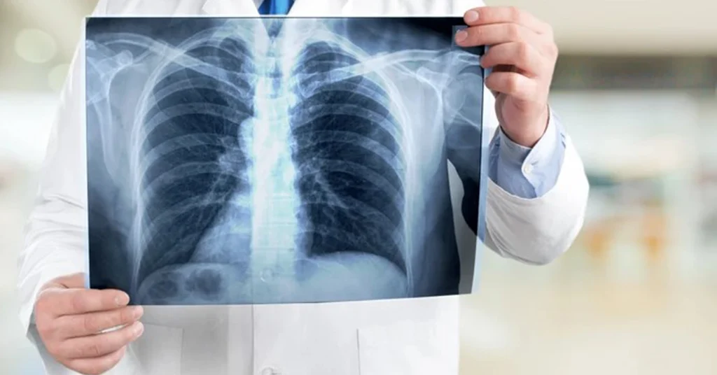 Menentukan Faktor Harga X Ray di Klinik Swasta