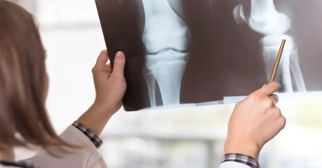 Apa Itu Pemeriksaan X Ray Kaki